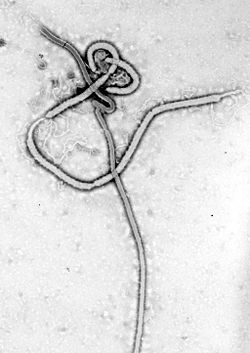 250px-Ebola_virus_em